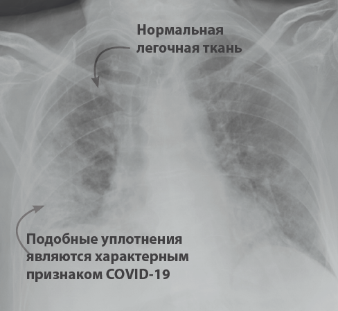 bulletin_june_2020_ru_graph_5.png
