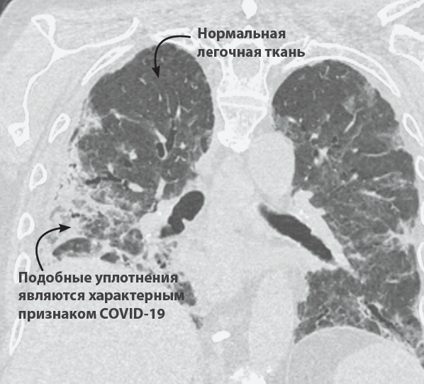 bulletin_june_2020_ru_graph_6.png