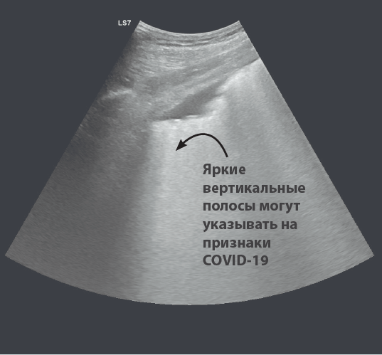 bulletin_june_2020_ru_graph_7.png