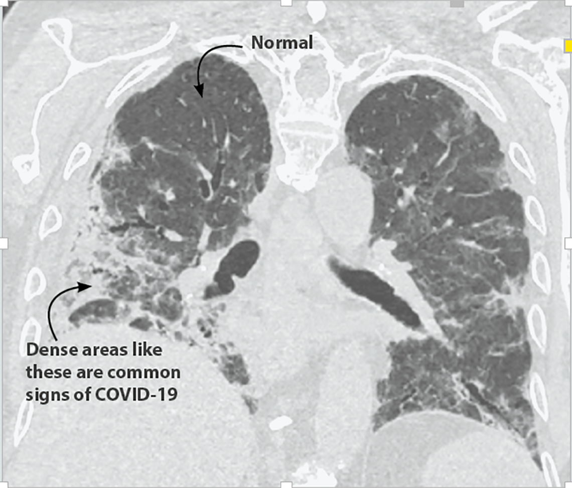 chest_ct.png