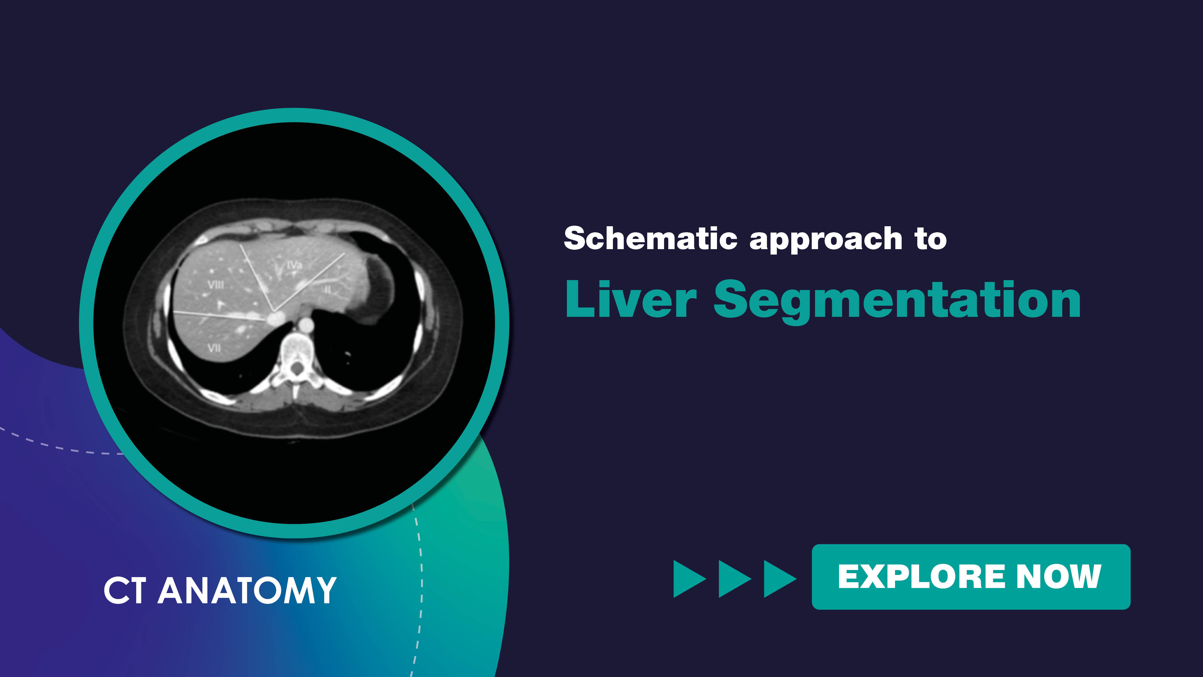 schematicapproachtoliversegmentation.jpg