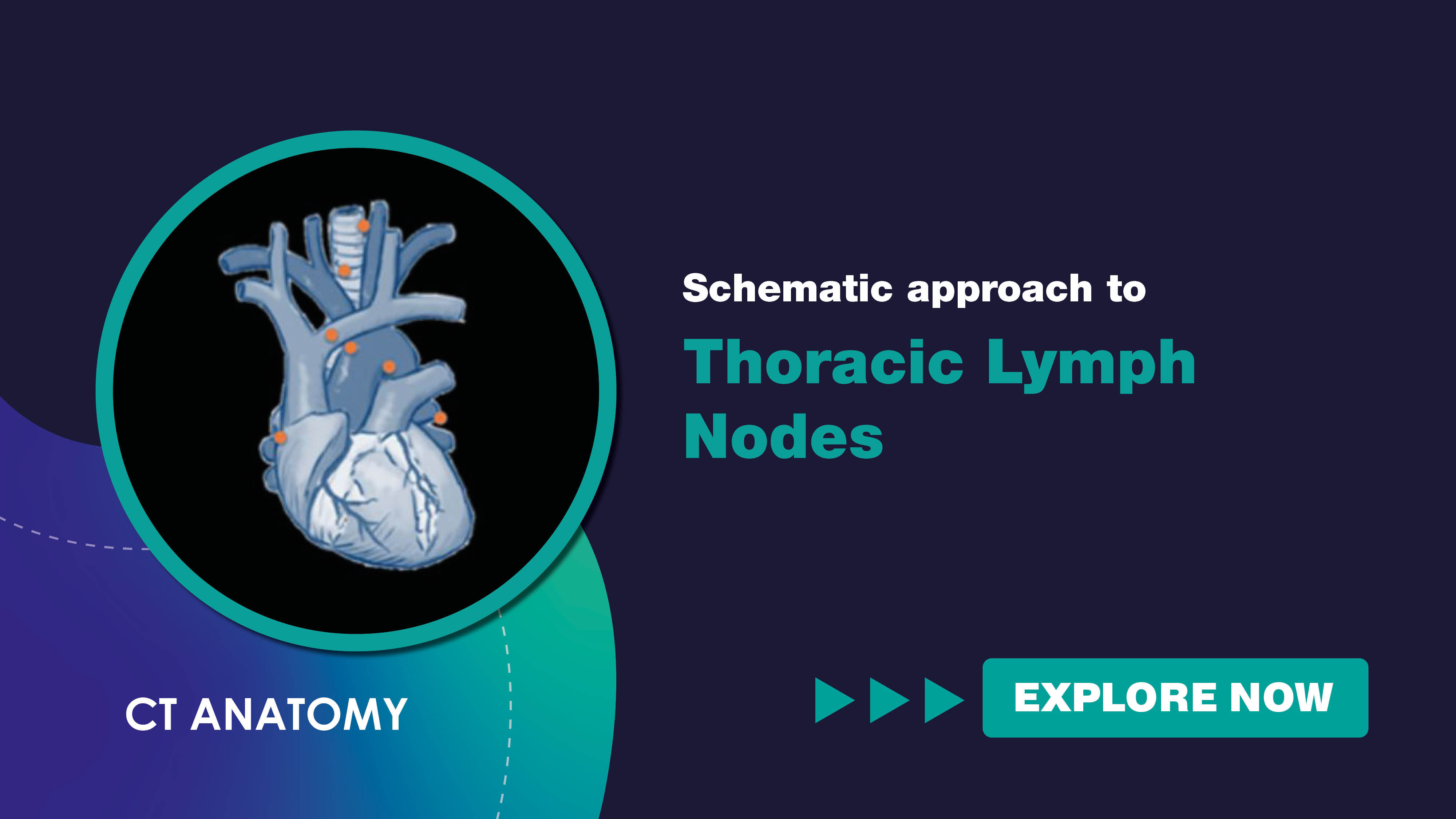 schematicapproachtothoraciclymphnodes.jpg