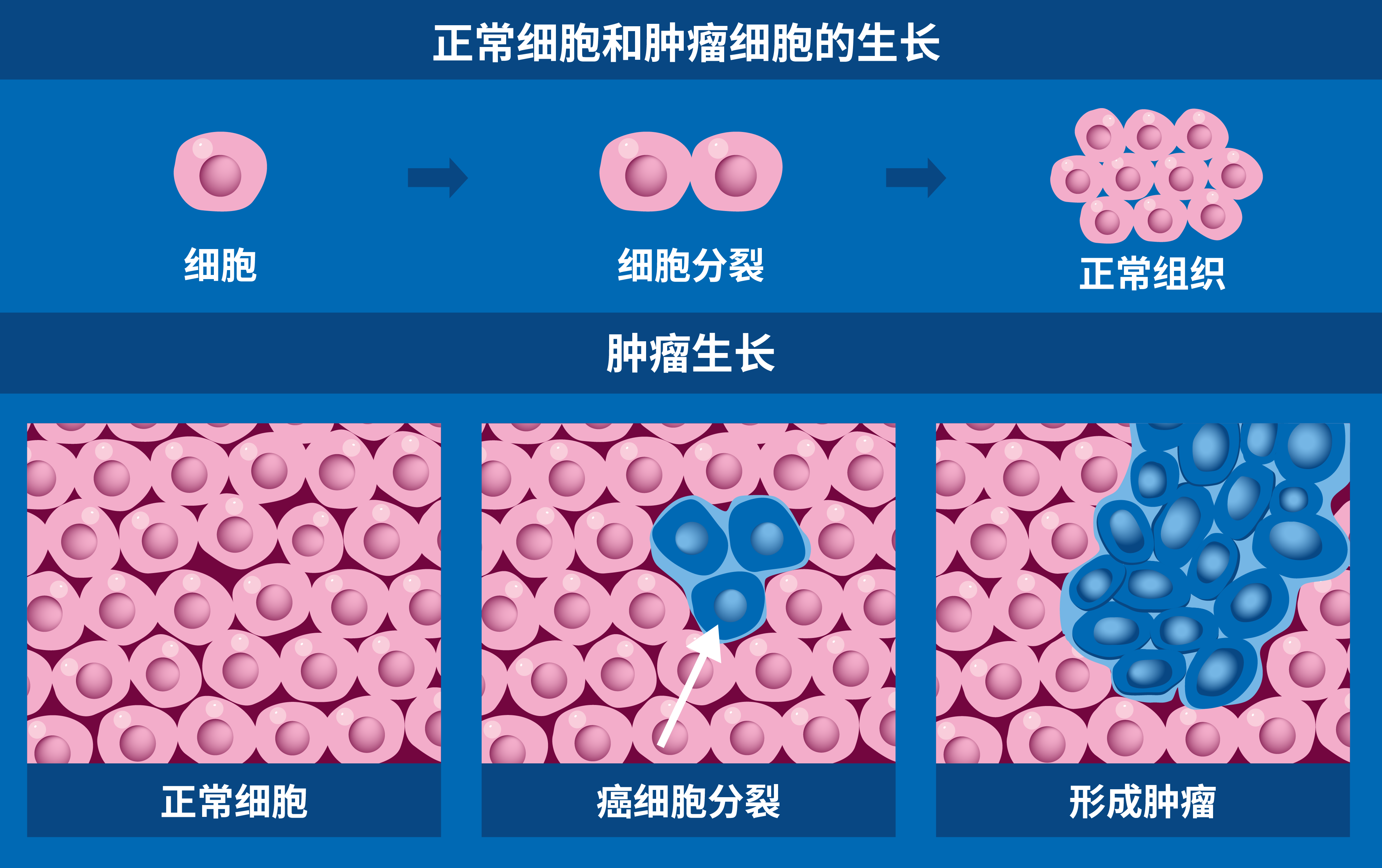 radiotherapy_v3_cancer_cell.png