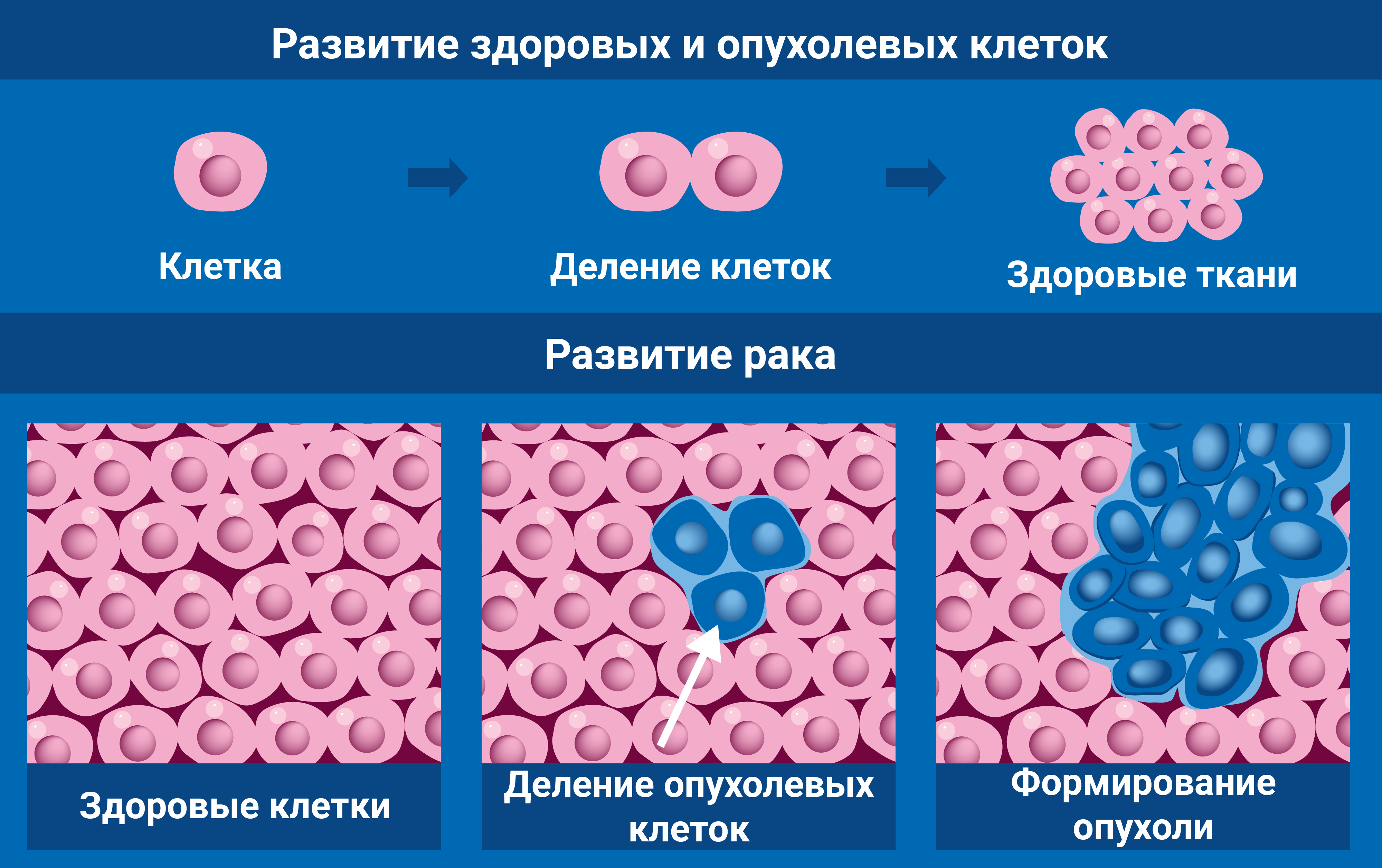 radiotherapy_v3_sp_-_copy_cancer_cell.png