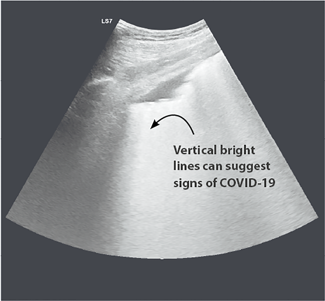 ultrasound.png